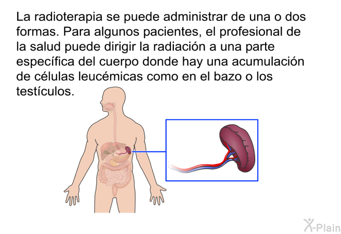La radioterapia se puede administrar de una o dos formas. Para algunos pacientes, el profesional de la salud puede dirigir la radiaci�n a una parte espec�fica del cuerpo donde hay una acumulaci�n de c�lulas leuc�micas como en el bazo o los test�culos.