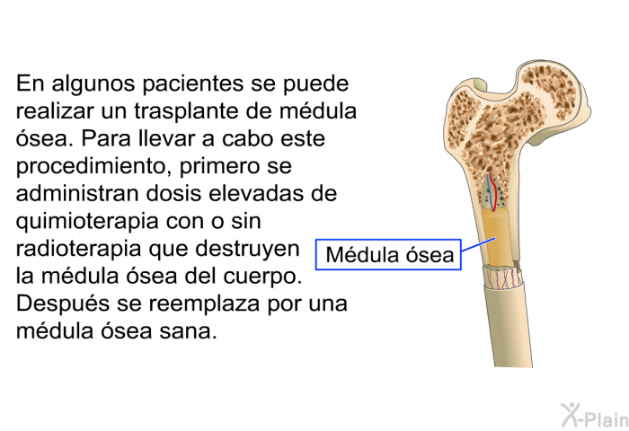 En algunos pacientes se puede realizar un trasplante de mdula sea. Para llevar a cabo este procedimiento, primero se administran dosis elevadas de quimioterapia con o sin radioterapia que destruyen la mdula sea del cuerpo. Despus se reemplaza por una mdula sea sana.