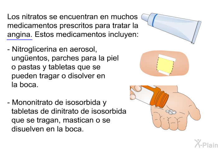 Los nitratos se encuentran en muchos medicamentos prescritos para tratar la angina. Estos medicamentos incluyen:  Nitroglicerina en aerosol, ung&uuml;entos, parches para la piel o pastas y tabletas que se pueden tragar o disolver en la boca. Mononitrato de isosorbida y tabletas de dinitrato de isosorbida que se tragan, mastican o se disuelven en la boca.