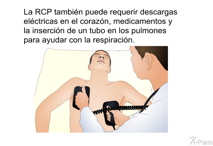 La RCP tambin puede requerir descargas elctricas en el corazn, medicamentos y la insercin de un tubo en los pulmones para ayudar con la respiracin.