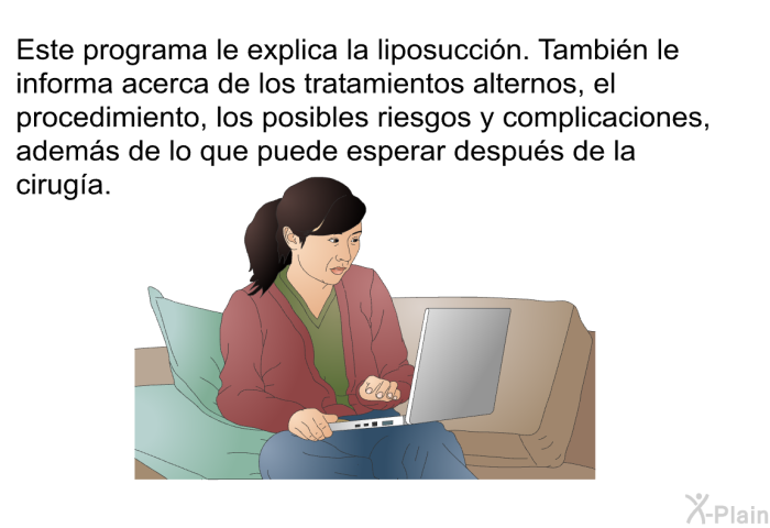 Este informacin acerca de su salud le explica la liposuccin. Tambin le informa acerca de los tratamientos alternos, el procedimiento, los posibles riesgos y complicaciones, adems de lo que puede esperar despus de la ciruga.