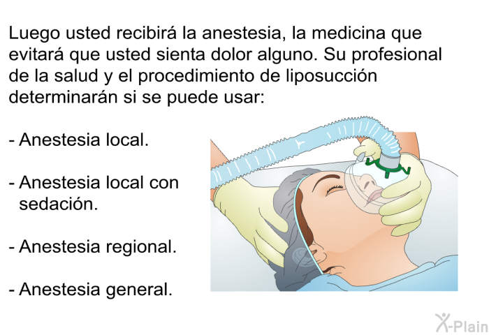 Luego usted recibir la anestesia, la medicina que evitar que usted sienta dolor alguno. Su profesional de la salud y el procedimiento de liposuccin determinarn si se puede usar:  Anestesia local. Anestesia local con sedacin. Anestesia regional. Anestesia general.