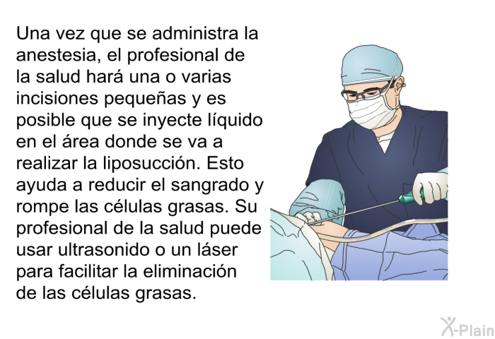 Una vez que se administra la anestesia, el profesional de la salud har una o varias incisiones pequeas y es posible que se inyecte lquido en el rea donde se va a realizar la liposuccin. Esto ayuda a reducir el sangrado y rompe las clulas grasas. Su profesional de la salud puede usar ultrasonido o un lser para facilitar la eliminacin de las clulas grasas.