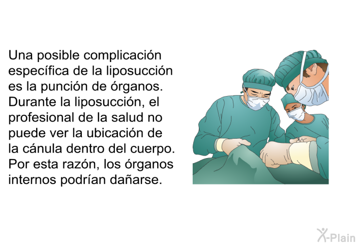 Una posible complicacin especfica de la liposuccin es la puncin de rganos. Durante la liposuccin, el profesional de la salud no puede ver la ubicacin de la cnula dentro del cuerpo. Por esta razn, los rganos internos podran daarse.