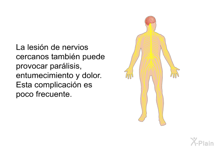 La lesin de nervios cercanos tambin puede provocar parlisis, entumecimiento y dolor. Esta complicacin es poco frecuente.