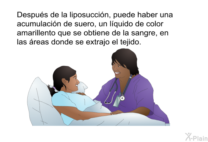 Despus de la liposuccin, puede haber una acumulacin de suero, un lquido de color amarillento que se obtiene de la sangre, en las reas donde se extrajo el tejido.