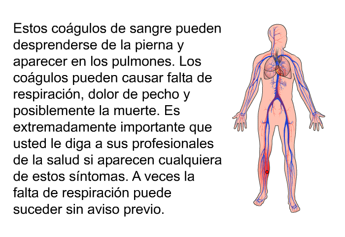 Estos cogulos de sangre pueden desprenderse de la pierna y aparecer en los pulmones. Los cogulos pueden causar falta de respiracin, dolor de pecho y posiblemente la muerte. Es extremadamente importante que usted le diga a sus profesionales de la salud si aparecen cualquiera de estos sntomas. A veces la falta de respiracin puede suceder sin aviso previo.