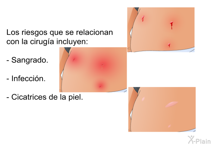 Los riesgos que se relacionan con la ciruga incluyen:  Sangrado. Infeccin. Cicatrices de la piel.