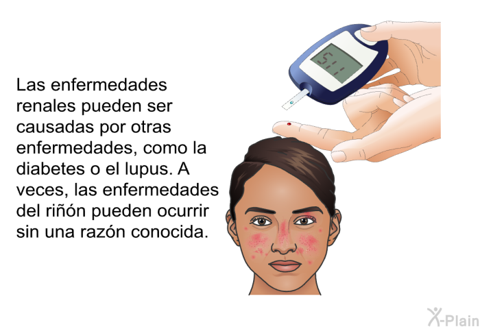 Las enfermedades renales pueden ser causadas por otras enfermedades, como la diabetes o el lupus. A veces, las enfermedades del rin pueden ocurrir sin una razn conocida.