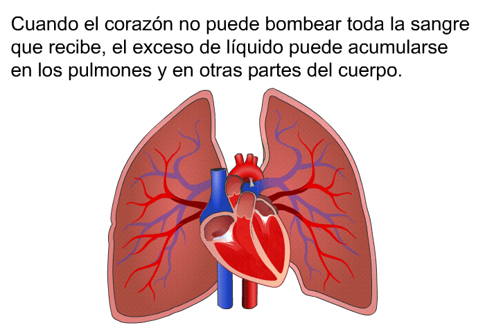Cuando el corazn no puede bombear toda la sangre que recibe, el exceso de lquido puede acumularse en los pulmones y en otras partes del cuerpo.
