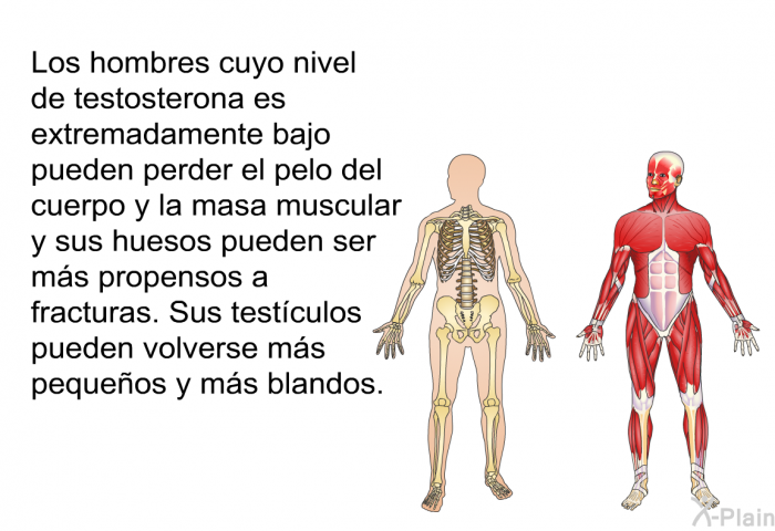 Los hombres cuyo nivel de testosterona es extremadamente bajo pueden perder el pelo del cuerpo y la masa muscular y sus huesos pueden ser ms propensos a fracturas. Sus testculos pueden volverse ms pequeos y ms blandos.