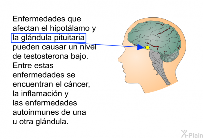 Enfermedades que afectan el hipot�lamo y la gl�ndula pituitaria pueden causar un nivel de testosterona bajo. Entre estas enfermedades se encuentran el c�ncer, la inflamaci�n y las enfermedades autoinmunes de una u otra gl�ndula.