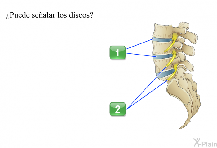 ¿Puede sealar los discos?