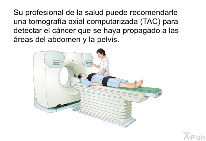 Su profesional de la salud puede recomendarle una tomografa axial computarizada (TAC) para detectar el cncer que se haya propagado a las reas del abdomen y la pelvis.