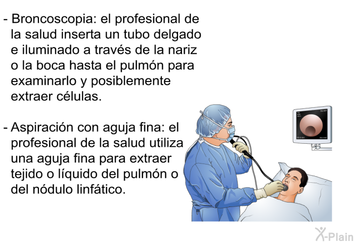 Broncoscopia: el profesional de la salud inserta un tubo delgado e iluminado a travs de la nariz o la boca hasta el pulmn para examinarlo y posiblemente extraer clulas. Aspiracin con aguja fina: el profesional de la salud utiliza una aguja fina para extraer tejido o lquido del pulmn o del ndulo linftico.