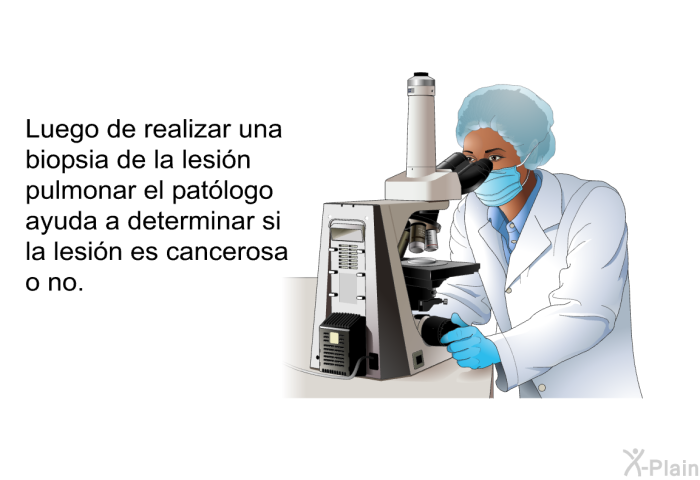 Luego de realizar una biopsia de la lesin pulmonar el patlogo ayuda a determinar si la lesin es cancerosa o no.