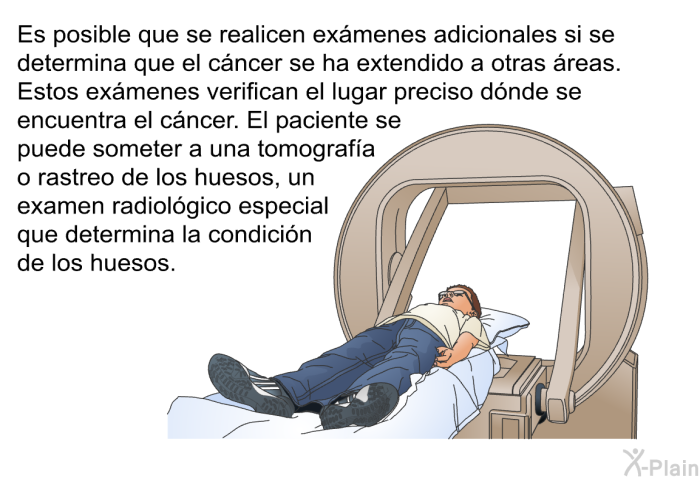 Es posible que se realicen exmenes adicionales si se determina que el cncer se ha extendido a otras reas. Estos exmenes verifican el lugar preciso dnde se encuentra el cncer. El paciente se puede someter a una tomografa o rastreo de los huesos, un examen radiolgico especial que determina la condicin de los huesos.