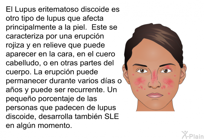 El <I>Lupus eritematoso discoide</I> es otro tipo de lupus que afecta principalmente a la piel. Este se caracteriza por una erupcin rojiza y en relieve que puede aparecer en la cara, en el cuero cabelludo, o en otras partes del cuerpo. La erupcin puede permanecer durante varios das o aos y puede ser recurrente. Un pequeo porcentaje de las personas que padecen de lupus discoide, desarrolla tambin SLE en algn momento.