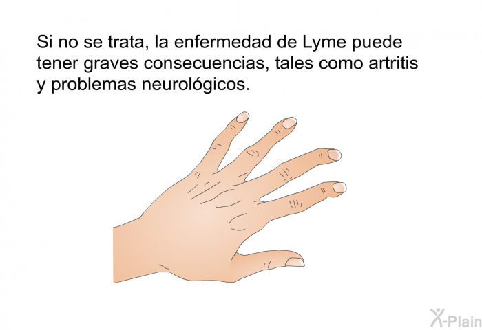 Si no se trata, la enfermedad de Lyme puede tener graves consecuencias, tales como artritis y problemas neurolgicos.