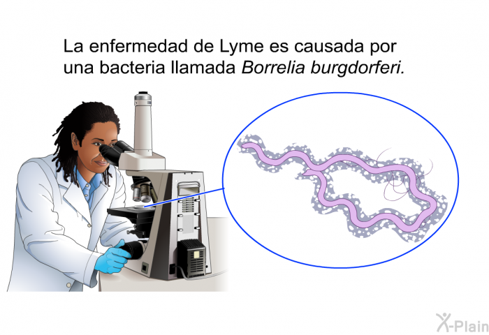 La enfermedad de Lyme es causada por una bacteria llamada <I>Borrelia burgdorferi</I>.