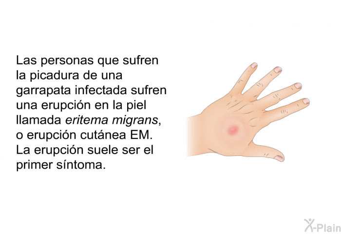 Las personas que sufren la picadura de una garrapata infectada sufren una erupcin en la piel llamada <I>eritema migrans</I>, o erupcin cutnea EM. La erupcin suele ser el primer sntoma.