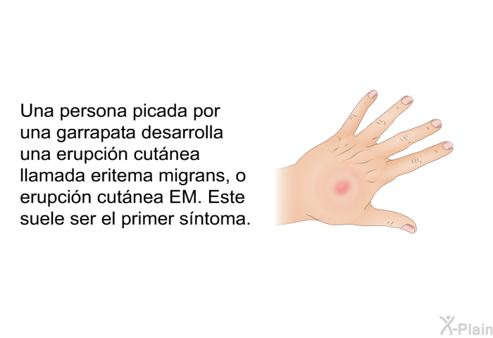 Una persona picada por una garrapata desarrolla una erupcin cutnea llamada <I>eritema migrans</I>, o erupcin cutnea EM. Este suele ser el primer sntoma.