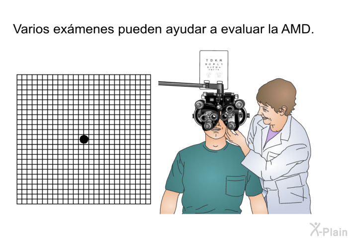 Varios exmenes pueden ayudar a evaluar la AMD.