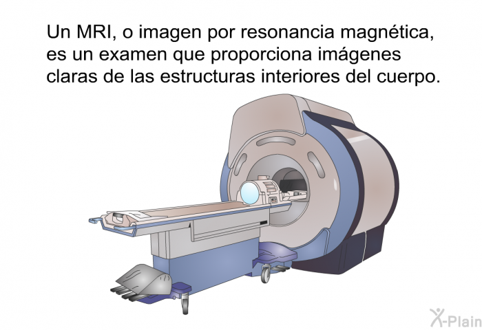Un MRI, o imagen por resonancia magntica, es un examen que proporciona imgenes claras de las estructuras interiores del cuerpo.