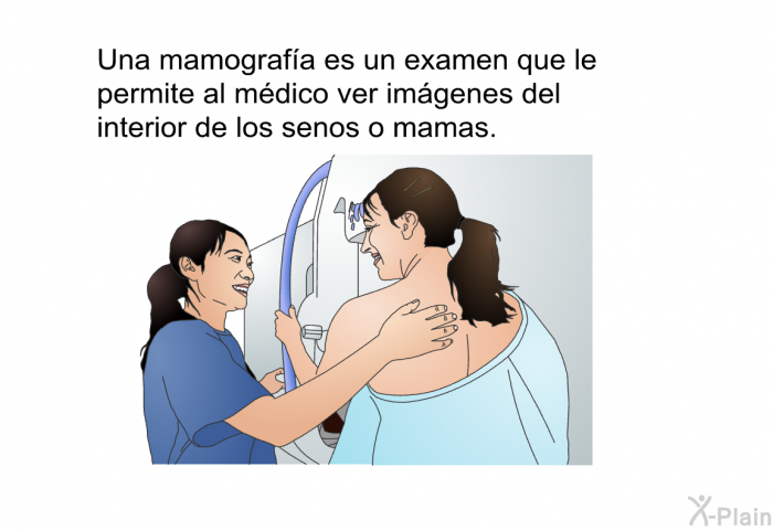 Una mamografa es un examen que le permite al mdico ver imgenes del interior de los senos o mamas.