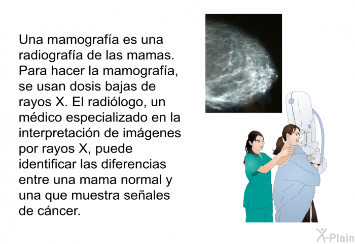 Una mamografa es una radiografa de las mamas. Para hacer la mamografa, se usan dosis bajas de rayos X. El radilogo, un mdico especializado en la interpretacin de imgenes por rayos X, puede identificar las diferencias entre una mama normal y una que muestra seales de cncer.
