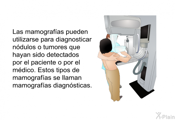 Las mamografas pueden utilizarse para diagnosticar ndulos o tumores que hayan sido detectados por el paciente o por el mdico. Estos tipos de mamografas se llaman mamografas diagnsticas.