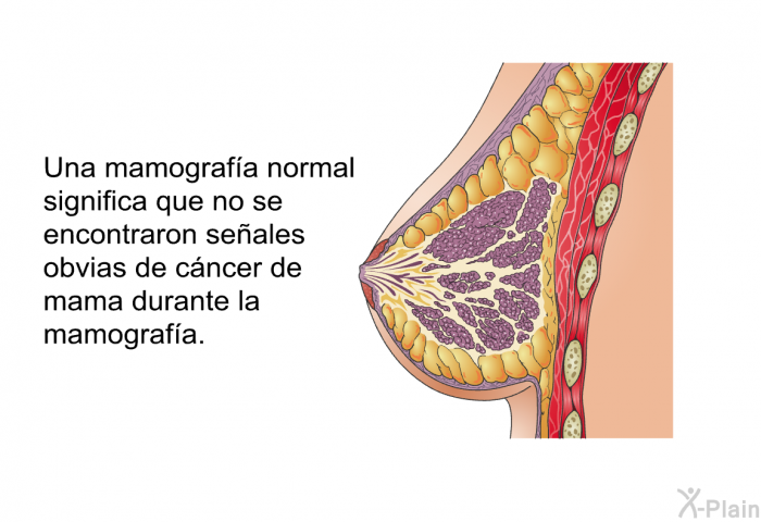 Una mamografa normal significa que no se encontraron seales obvias de cncer de mama durante la mamografa.