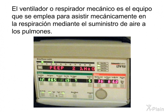 El ventilador o respirador mecnico es el equipo que se emplea para asistir mecnicamente en la respiracin mediante el suministro de aire a los pulmones.