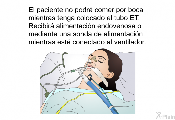 El paciente no podr comer por boca mientras tenga colocado el tubo ET. Recibir alimentacin endovenosa o mediante una sonda de alimentacin mientras est conectado al ventilador.