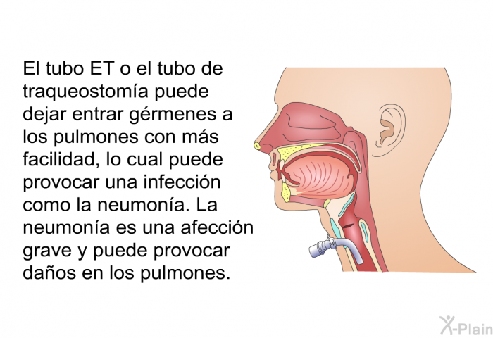 El tubo ET o el tubo de traqueostoma puede dejar entrar grmenes a los pulmones con ms facilidad, lo cual puede provocar una infeccin como la neumona. La neumona es una afeccin grave y puede provocar daos en los pulmones.