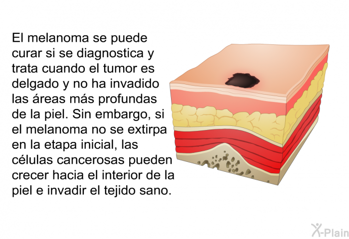 El melanoma se puede curar si se diagnostica y trata cuando el tumor es delgado y no ha invadido las �reas m�s profundas de la piel. Sin embargo, si el melanoma no se extirpa en la etapa inicial, las c�lulas cancerosas pueden crecer hacia el interior de la piel e invadir el tejido sano.