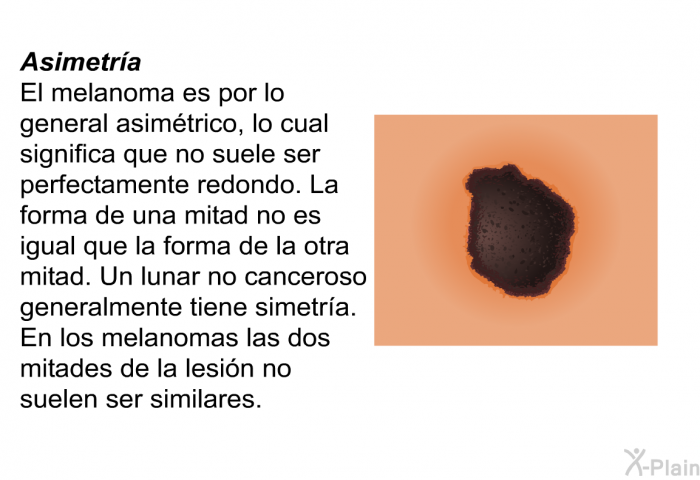 <B>Asimetr�a:</B> El melanoma es por lo general asim�trico, lo cual significa que no suele ser perfectamente redondo. La forma de una mitad no es igual que la forma de la otra mitad. Un lunar no canceroso generalmente tiene simetr�a. En los melanomas las dos mitades de la lesi�n no suelen ser similares.