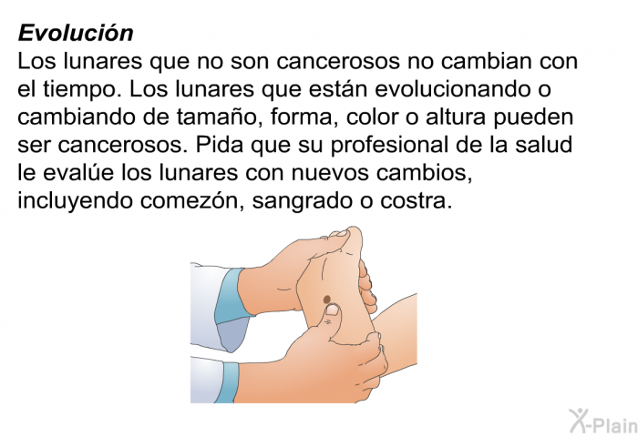 <B>Evoluci�n:</B> Los lunares que no son cancerosos no cambian con el tiempo. Los lunares que est�n evolucionando o cambiando de tama�o, forma, color o altura pueden ser cancerosos. Pida que su profesional de la salud le eval�e los lunares con nuevos cambios, incluyendo comez�n, sangrado o costra.