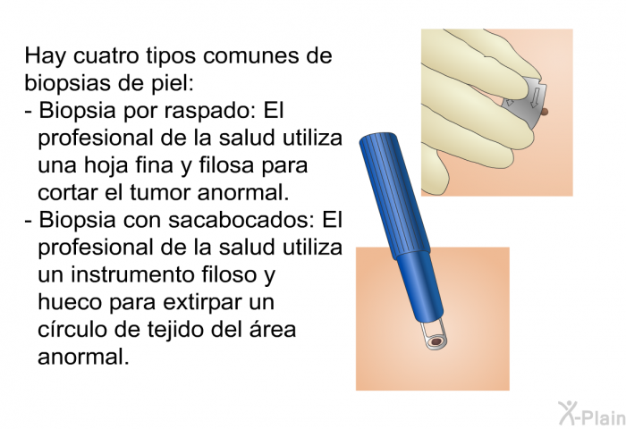 Hay cuatro tipos comunes de biopsias de piel:  Biopsia por raspado: El profesional de la salud utiliza una hoja fina y filosa para cortar el tumor anormal. Biopsia con sacabocados: El profesional de la salud utiliza un instrumento filoso y hueco para extirpar un c�rculo de tejido del �rea anormal.