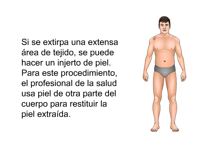 Si se extirpa una extensa rea de tejido, se puede hacer un injerto de piel. Para este procedimiento, el profesional de la salud usa piel de otra parte del cuerpo para restituir la piel extrada.