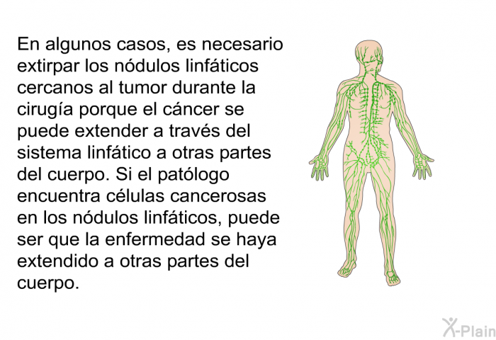 En algunos casos, es necesario extirpar los ndulos linfticos cercanos al tumor durante la ciruga porque el cncer se puede extender a travs del sistema linftico a otras partes del cuerpo. Si el patlogo encuentra clulas cancerosas en los ndulos linfticos, puede ser que la enfermedad se haya extendido a otras partes del cuerpo.