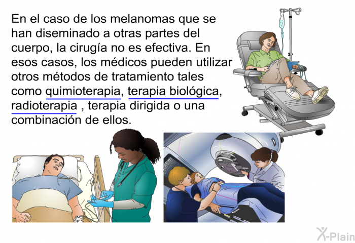 En el caso de los melanomas que se han diseminado a otras partes del cuerpo, la ciruga no es efectiva. En esos casos, los mdicos pueden utilizar otros mtodos de tratamiento tales como quimioterapia, terapia biolgica, radioterapia, terapia dirigida o una combinacin de ellos.