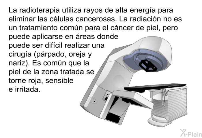 La radioterapia utiliza rayos de alta energa para eliminar las clulas cancerosas. La radiacin no es un tratamiento comn para el cncer de piel, pero puede aplicarse en reas donde puede ser difcil realizar una ciruga (prpado, oreja y nariz). Es comn que la piel de la zona tratada se torne roja, sensible e irritada.