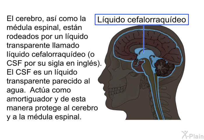 El cerebro, as� como la m�dula espinal, est�n rodeados por un l�quido transparente llamado l�quido cefalorraqu�deo (o CSF por su sigla en ingl�s).&nbsp; El CSF es un l�quido transparente parecido al agua.&nbsp; Act�a como amortiguador y de esta manera protege al cerebro y &nbsp;a la m�dula espinal.