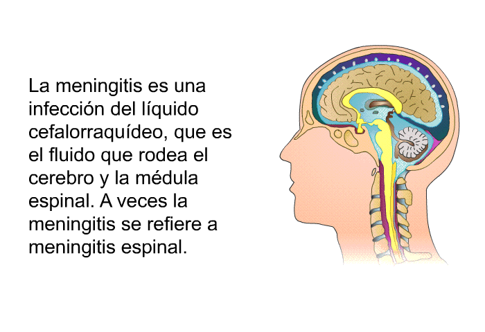 La meningitis es una infeccin del lquido cefalorraqudeo, que es el fluido que rodea el cerebro y la mdula espinal. A veces la meningitis se refiere a meningitis espinal.
