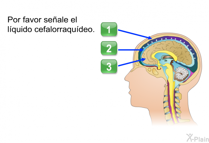 Por favor seale el lquido cefalorraqudeo.