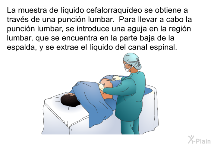 La muestra<B> </B>de l�quido cefalorraqu�deo se obtiene a trav�s de una punci�n lumbar. Para llevar a cabo la punci�n lumbar, se introduce una aguja en la regi�n lumbar, que se encuentra en la parte baja de la espalda, y se extrae el l�quido del canal espinal.