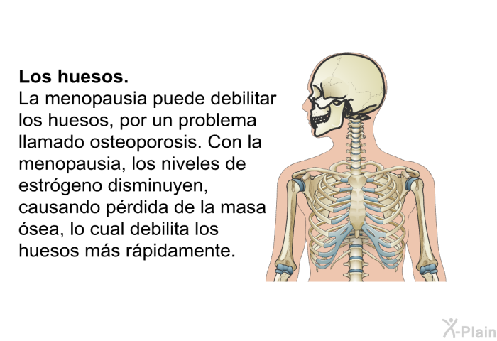 <B>Los huesos: </B> La menopausia puede debilitar los huesos, por un problema llamado osteoporosis. Con la menopausia, los niveles de estr�geno disminuyen, causando p�rdida de la masa �sea, lo cual debilita los huesos m�s r�pidamente.
