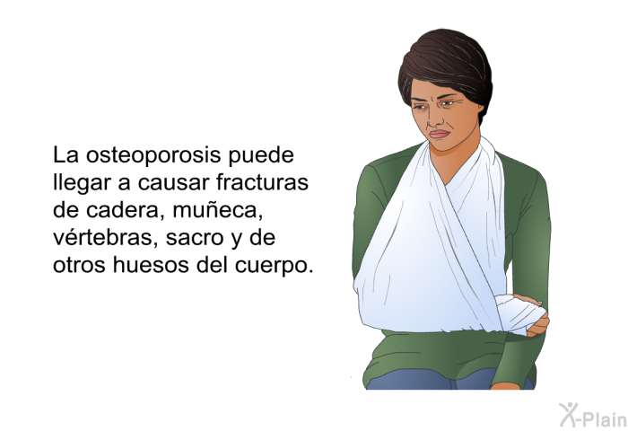 La osteoporosis puede llegar a causar fracturas de cadera, mu�eca, v�rtebras, sacro y de otros huesos del cuerpo.