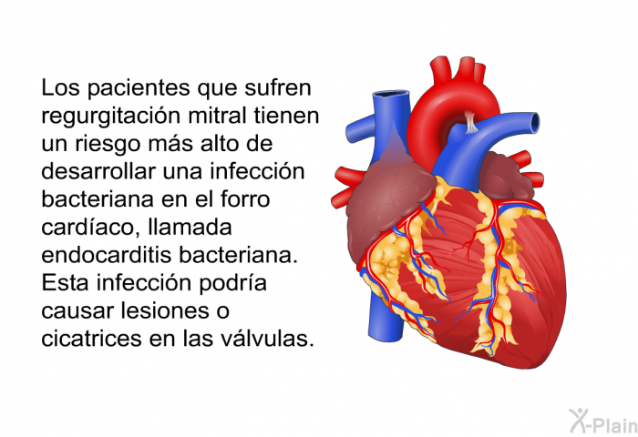 Los pacientes que sufren regurgitacin mitral tienen un riesgo ms alto de desarrollar una infeccin bacteriana en el forro cardaco, llamada endocarditis bacteriana. Esta infeccin podra causar lesiones o cicatrices en las vlvulas.